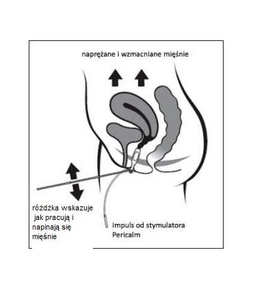 Periform Plus - sonda/elektroda dopochwowa, do użytku domowego i klinicznego