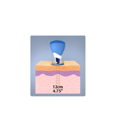 Bańki HACI gumowe z magnesem - komplet 10 sztuk