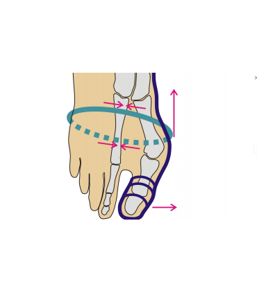 Skarpety korekcyjne na halluks-valgus Arthrolux - ZA KOSTKĘ